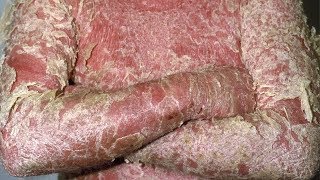 Erythrodermic psoriasis images photos pictures erythroderma symptoms [upl. by Warchaw]