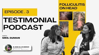 Folliculitis on the Head Dr Megha amp Mrs Suman Share Real Experiences Testimonial Podcast [upl. by Ratep]