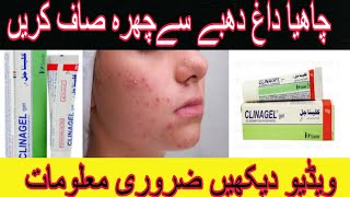 Clina gel Benefits in Urdu  Dagh Dhaby khtm krein sahiinformation [upl. by Augusto]