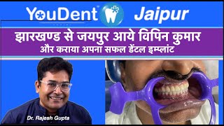 Vipin Kumar का हुआ सफल Dental Implant जानिए कैसे   By Dr Rajesh Gupta [upl. by Aikim]