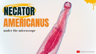 Necator americanus under the microscope [upl. by Neral]