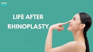 Life after Rhinoplasty [upl. by Sualokin218]