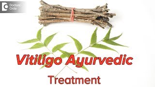 How can we treat vitiligowhite patchesthrough Ayurveda  Dr Mini Nair [upl. by Bibby768]