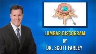 What is a Lumbar Discogram [upl. by Shaylynn]