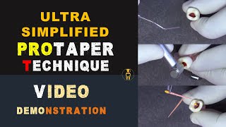 Ultra Simplified Protaper Technique  Video demonstration [upl. by Merrile136]