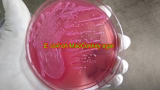 E coli on MacConkey agar blood agar and Chocolate agar [upl. by Almeeta]