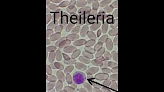 Schizont of Theileria Spp in Lymphocyte [upl. by Gujral]