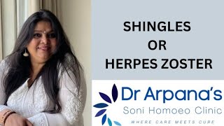 SHINGLES DISEASE OR HERPES ZOSTER [upl. by Siubhan]