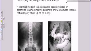 A level Medical Physics  X rays  image intensifiers and contrast media [upl. by Hester]