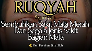 🔴RUQYAH SAKIT MATA MERAH BENGKAK DAN SEGALA JENIS SAKIT MATA SEMBUH KUN FAYAKUN [upl. by Ecinej832]