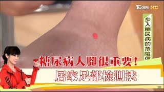 糖尿病人腳很重要！「居家足部檢測」觀察下肢血管防病變 健康20 [upl. by Ayikin]