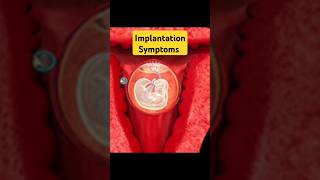 Very first Pregnancy Symptom earlypregnancy pregnancysymptomsinhindi implantation pregnancy [upl. by Seabrook230]