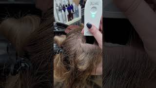 Scalp Treatment for Dandruff and Buildup dandruffremoval [upl. by Jarlen]