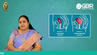 What is Retroverted Uterus பின்னோக்கிய கருப்பை குழந்தையின்மைக்கு காரணமா Dr Buvaneswari Explains [upl. by Chang]