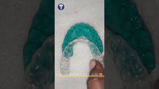 Toothsi  Dentist Lab World  Orthodontics Teeth Treatment  Painless  Tamil Dental Lab🦷dentallab [upl. by Aivul]