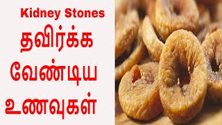 சிறுநீரக கற்கள் வராமல் இருக்க தவிர்க்க வேண்டிய உணவுகள்  Kidney stone Cure foods to avoid [upl. by Aenotna]