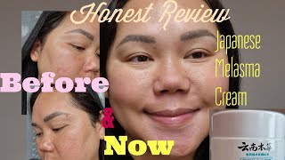 Japanese Melasma CreamMy Honest Review 1 Bottle used🙂😀😃 [upl. by Rawdon]