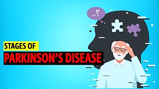 Stages of Parkinsons disease [upl. by Yellat806]