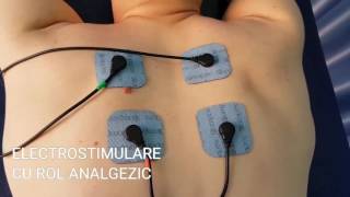 Electrostimulare împotriva durerilor de spate  TOPKINETO Recuperare Medicală [upl. by Analihp]