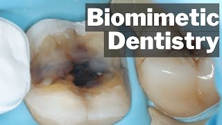 Biomimetic Dentistry  What Actually Is It  PDP135 [upl. by Norman]