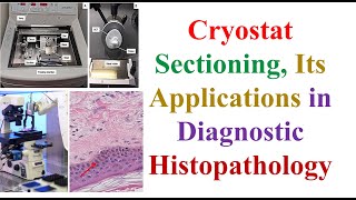 Cryostat Sectioning Its Applications in Diagnostic Histo 5th MLS HISTOTECHNOLOGY – 2 Cytology [upl. by Nalliuq]