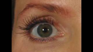 BeforeAfter latisse lashes [upl. by Inga]