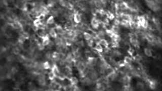 Example twophoton Ca2 imaging of cerebellar granule cells [upl. by Ainel676]