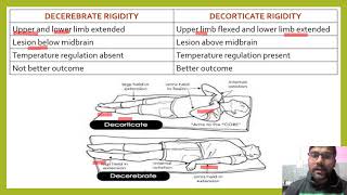 DIFFERENCE BETWEEN DECEREBRATE AND DECORTICATE RIGIDITY DECORTICATERIGIDITY DECEREBRATERIGIDITY [upl. by Anais]