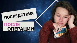 Осложнения после удаления щитовидки  диффузно токсический зоб гипертиреоз [upl. by Balbinder91]