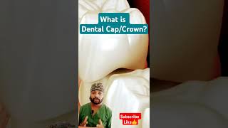 Animated Dental Crown Procedure yt shorts ytviral dentalcap crown zirconiacrown dentist [upl. by Rolyak785]