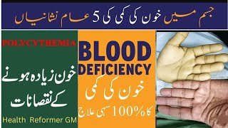 Anemia causessymptoms and treatement urdu hindi Khoon ki kami ka ilagHow to improve hemoglobin [upl. by Owiat947]