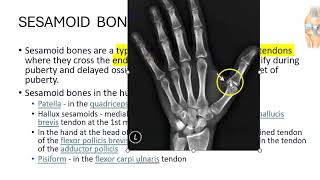 Anatomy 201 Sesamoid Bone Patella Pisiform Carpal bones Define Solved Question Paper [upl. by Yralih]