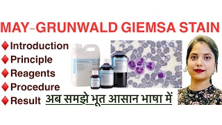 MayGrunwald giemsa stain Mgg in Hindi  Principle  Procedure  Reagents  MLT [upl. by Zerep]