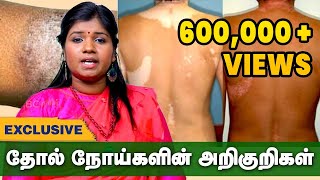 எல்லா தோல் நோய்களுக்கும் இதுதான் தீர்வு  Skin Diseases Treatment in Siddha Thol Noi Pirachanai [upl. by Malcom66]