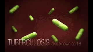 CDC Tuberculosis TB Transmission and Pathogenesis Video [upl. by Heber20]