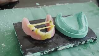 Denture Repair  Prosthodontics [upl. by Adnoel667]