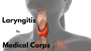 Laryngitis General OPD TopicsMedical Corps 🩺 [upl. by Ldnek557]