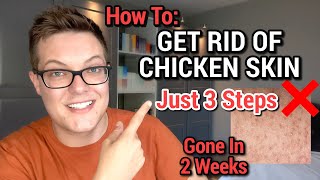 How To Get Rid Of Chicken Skin  KERATOSIS PILARIS SKINCARE ROUTINE [upl. by Marinna]