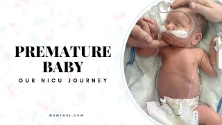 PREMATURE BABY Born at 35 weeks  Our NICU Journey 💗 [upl. by Yekcim]