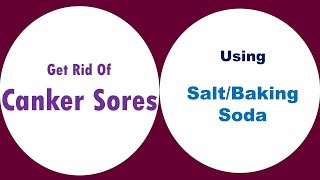 Get Rid Of Canker Sores With SaltBaking Soda [upl. by Marentic]