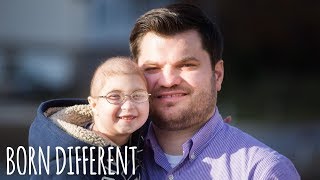 My Rare Dwarfism Makes Me 1 in 4 Million  BORN DIFFERENT [upl. by Ttennej]