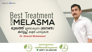 Melasma Malayalam  മുഖത്തു ഉണ്ടാവുന്ന കറുത്ത പാടുകള്‍  Mukhathe Karutha Padukal Maran Dr Shareef [upl. by Boggs558]