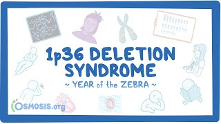 1p36 deletion syndrome Year of the Zebra [upl. by Xuaeb]