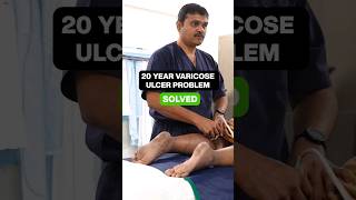 Miracle Cure for Chronic LEG ULCER shortsviral varicoseveinstreatment IVUS [upl. by Annnora386]