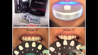 Whitening Lightning How to Whiten Your Teeth in 20 Minutes [upl. by Wilmette289]