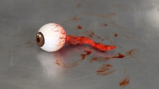 EYEBALL FALLS OUT [upl. by Gallager233]