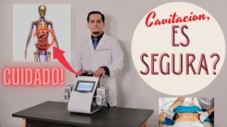 Es Segura la Cavitacion [upl. by Sadowski]