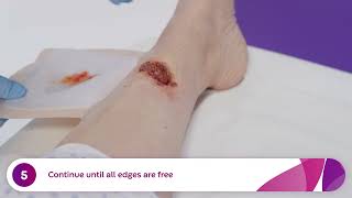 How to Apply and Remove Aquacel® Ag Foam Dressings Venous Leg Ulcer [upl. by Aryl]