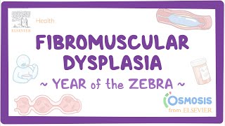 Fibromuscular dysplasia Year of the Zebra [upl. by Brosy306]