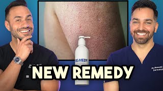 Keratosis Pilaris Crepey Skin New Product Alert from Remedy Science 🚨 [upl. by Anavlis]